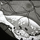 vitreous snowballs, peripheral retinal neovascularization, inferior snowbanking, vascular sheathing, and peripheral exudative retinal detachment